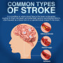 Stroke Program