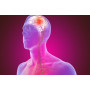 Stroke Program